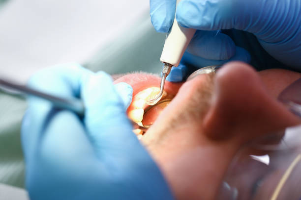 Best Emergency Dental Care for Trauma or Injury in Rhinelander, WI