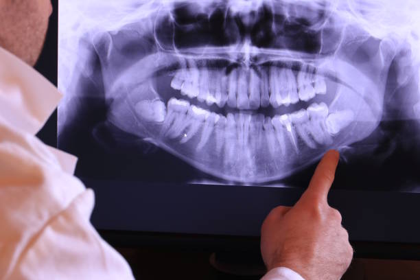 Best Emergency Treatment for Toothache in Rhinelander, WI
