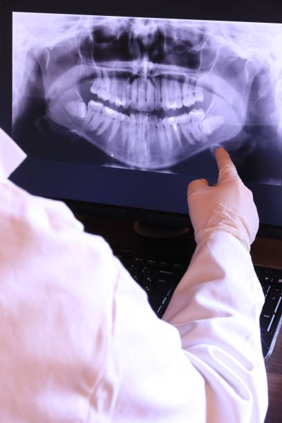 Best Emergency Root Canal Treatment in Rhinelander, WI